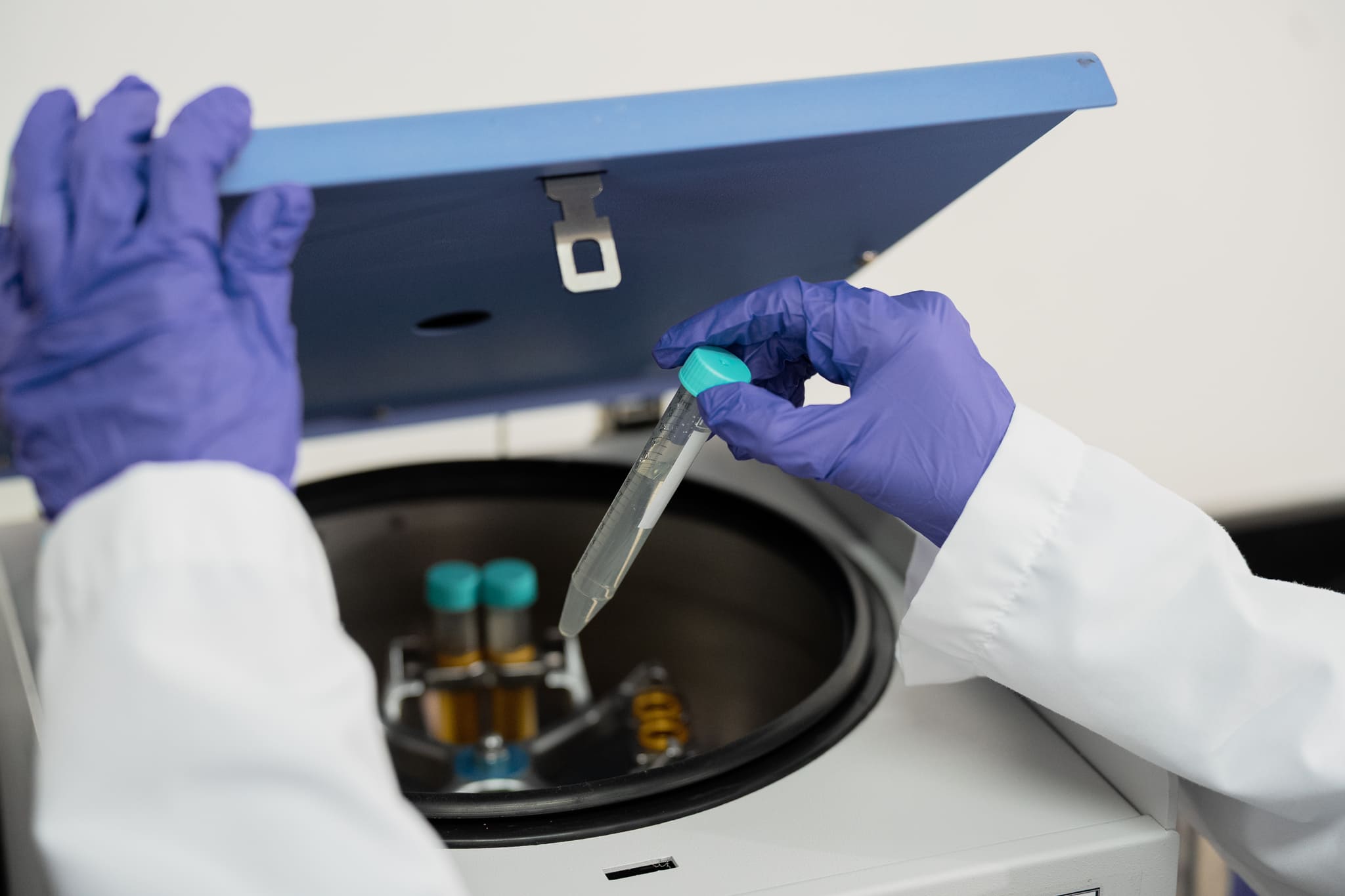 Peritone Production Stock Photo-81